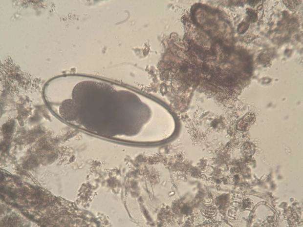 Яйца стронгилят лосей – Nematodirus sp. (10 х)